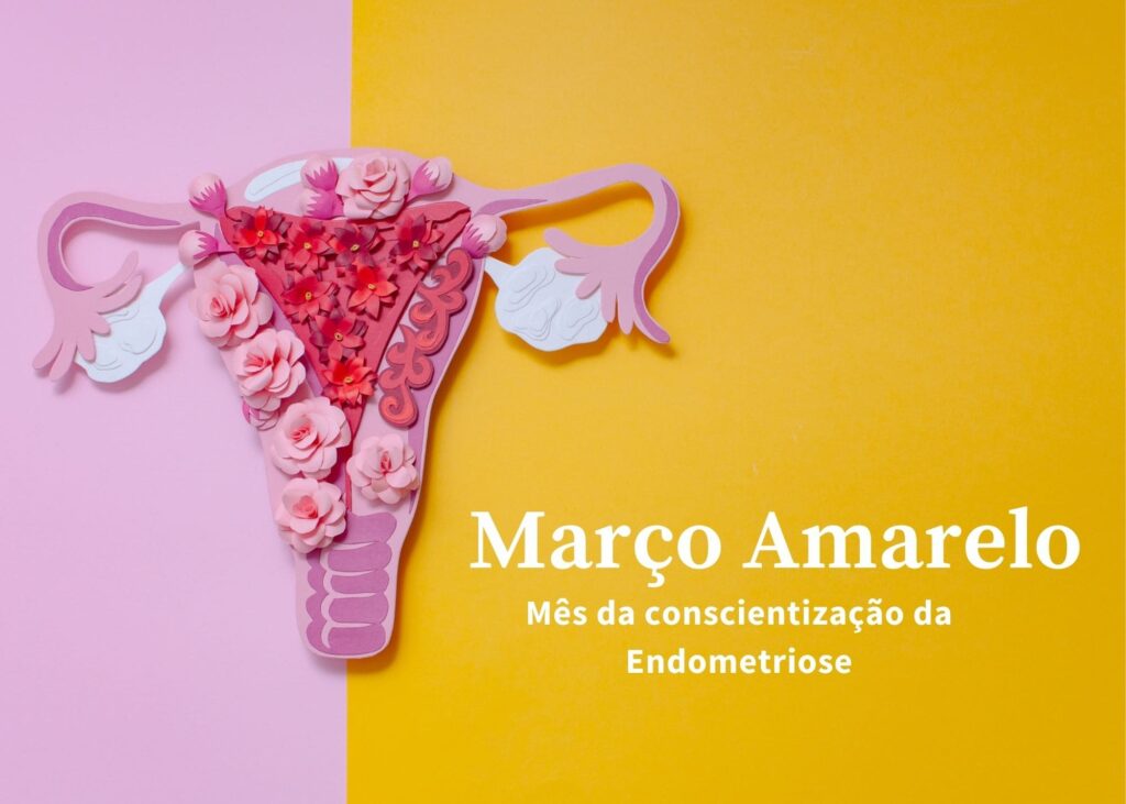 Endometriose: doença atinge uma a cada 10 mulheres no Brasil